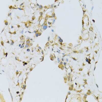 Immunohistochemistry-Paraffin: RPL13 Antibody [NBP2-94875] - Human lung using RPL13 antibody at dilution of 1:100 (40x lens).