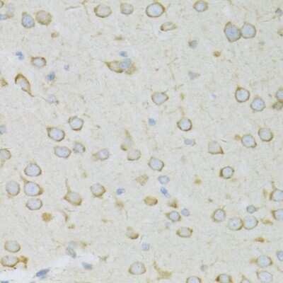 Immunohistochemistry-Paraffin: RPL13 Antibody [NBP2-94875] - Rat brain using RPL13 antibody at dilution of 1:100 (40x lens).