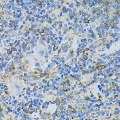 Immunohistochemistry-Paraffin: RPL13 Antibody [NBP2-94875] - Rat spleen using RPL13 antibody at dilution of 1:100 (40x lens).