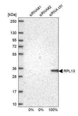 Western Blot: RPL13 Antibody [NBP2-13250] - Analysis in U2OS cells transfected with control siRNA, target specific siRNA probe #1 and #2. Remaining relative intensity is presented.