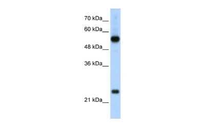 Western Blot: RPL13 Antibody [NBP2-88183] - WB Suggested Anti-RPL13 Antibody Titration: 2.5ug/ml. Positive Control: HepG2 cell lysateThere is BioGPS gene expression data showing that RPL13 is expressed in HepG2