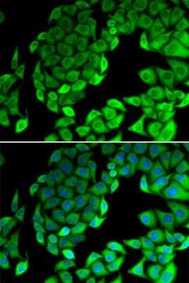 Immunocytochemistry/Immunofluorescence: RPL14 Antibody [NBP2-94093] - Analysis of MCF-7 cells using RPL14 . Blue: DAPI for nuclear staining.