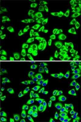 Immunocytochemistry/Immunofluorescence: RPL14 Antibody [NBP2-94115] - Analysis of MCF7 cells using RPL14 . Blue: DAPI for nuclear staining.