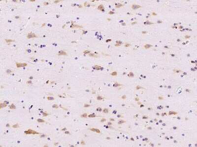 Immunohistochemistry-Paraffin: RPL14 Antibody [NBP2-97838] - Immunochemical staining of human RPL14 in human brain with rabbit polyclonal antibody at 1:500 dilution, formalin-fixed paraffin embedded sections.