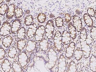 Immunohistochemistry-Paraffin: RPL14 Antibody [NBP2-97838] - Immunochemical staining of human RPL14 in human rectum with rabbit polyclonal antibody at 1:500 dilution, formalin-fixed paraffin embedded sections.