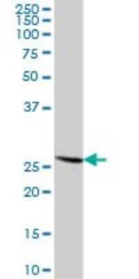 Western Blot: RPL14 Antibody [H00009045-B01P] - Analysis of RPL14 expression in human kidney.