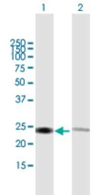 Western Blot: RPL14 Antibody [H00009045-B01P] - Analysis of RPL14 expression in transfected 293T cell line by RPL14 polyclonal antibody.  Lane 1: RPL14 transfected lysate(24.2 KDa). Lane 2: Non-transfected lysate.