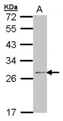 Western Blot: RPL14 Antibody [NBP1-33068] - Sample (30 ug of whole cell lysate) A: 293T 12% SDS PAGE; antibody diluted at 1:1000.