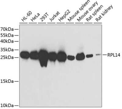 Western Blot: RPL14 Antibody [NBP2-94093] - Analysis of extracts of various cell lines, using RPL14 at 1:1000 dilution. Secondary antibody: HRP Goat Anti-Rabbit IgG (H+L) at 1:10000 dilution. Lysates/proteins: 25ug per lane. Blocking buffer: 3% nonfat dry milk in TBST. Detection: ECL Basic Kit . Exposure time: 10s.