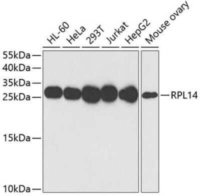 Western Blot: RPL14 Antibody [NBP2-94115] - Analysis of extracts of various cell lines, using RPL14 at 1:1000 dilution. Secondary antibody: HRP Goat Anti-Rabbit IgG (H+L) at 1:10000 dilution. Lysates/proteins: 25ug per lane. Blocking buffer: 3% nonfat dry milk in TBST. Detection: ECL Basic Kit . Exposure time: 10s.