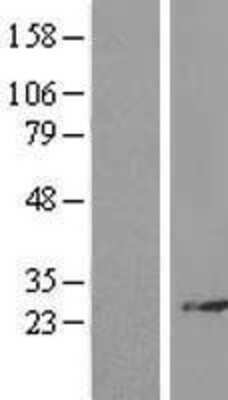 Western Blot: RPL14 Overexpression Lysate (Adult Normal) [NBL1-15506] Left-Empty vector transfected control cell lysate (HEK293 cell lysate); Right -Over-expression Lysate for RPL14.