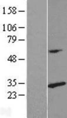 Western Blot: RPL14 Overexpression Lysate (Adult Normal) [NBL1-15507] Left-Empty vector transfected control cell lysate (HEK293 cell lysate); Right -Over-expression Lysate for RPL14.