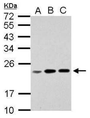 Western Blot RPL17P7 Antibody - BSA Free