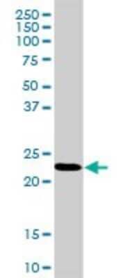 Western Blot RPL18 Antibody