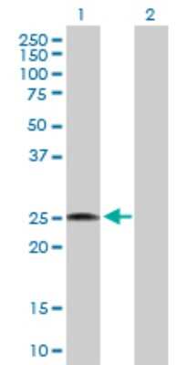 Western Blot: RPL18 Antibody [H00006141-D01P] - Analysis of RPL18 expression in transfected 293T cell line by RPL18 polyclonal antibody.Lane 1: RPL18 transfected lysate(21.60 KDa).Lane 2: Non-transfected lysate.