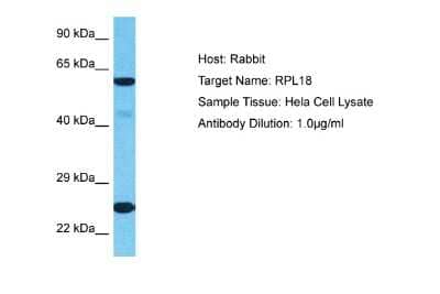 Western Blot: RPL18 Antibody [NBP2-88186] - Host: Rabbit. Target Name: RPL18. Sample Type: Hela Whole Cell lysates. Antibody Dilution: 1.0ug/ml