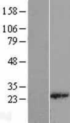 Western Blot: RPL18 Overexpression Lysate (Adult Normal) [NBL1-15511] Left-Empty vector transfected control cell lysate (HEK293 cell lysate); Right -Over-expression Lysate for RPL18.