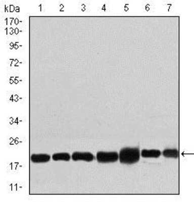 Western Blot: RPL18A Antibody (6G6G10) [NBP2-37396] - Western blot analysis using RPL18A mouse mAb against NIH3T3 (1), HEK293 (2), HL60 (3), Jurkat (4), Raji (5), MOLT4 (6), and HeLa (7) cell lysate.