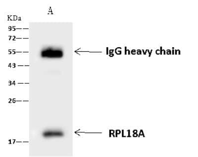 Immunoprecipitation: RPL18A Antibody [NBP2-97781] - RPL18A was immunoprecipitated using: Lane A: 0.5 mg U-251MG Whole Cell Lysate 4 ul anti-RPL18A rabbit polyclonal antibody and 60 ug of Immunomagnetic beads Protein A/G.  Primary antibody: Anti-RPL18A rabbit polyclonal antibody, at 1:100 dilution. Secondary antibody: Goat Anti-Rabbit IgG (H+L)/HRP at 1/10000 dilution. Developed using the ECL technique. Performed under reducing conditions. Predicted band size: 21 kDa. Observed band size: 21 kDa