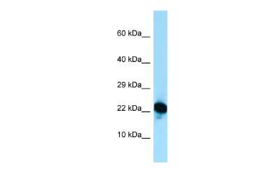Western Blot: RPL18A Antibody [NBP2-88187] - Host: Rabbit. Target Name: RPL18A. Sample Type: Jurkat Whole Cell lysates. Antibody Dilution: 1.0ug/ml