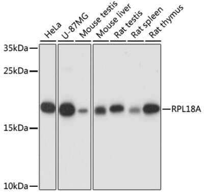 Western Blot: RPL18A Antibody [NBP2-94833] - Analysis of extracts of various cell lines, using RPL18A at 1:1000 dilution. Secondary antibody: HRP Goat Anti-Rabbit IgG (H+L) at 1:10000 dilution. Lysates/proteins: 25ug per lane. Blocking buffer: 3% nonfat dry milk in TBST. Detection: ECL Basic Kit . Exposure time: 1s.