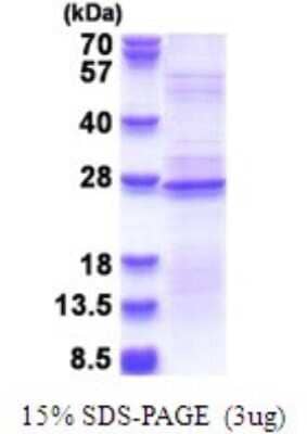 SDS-PAGE Recombinant Human RPL18A His Protein