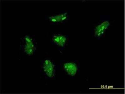 Immunocytochemistry/Immunofluorescence: RPL21 Antibody (2D8) [H00006144-M03] - Analysis of monoclonal antibody to RPL21 on HeLa cell. Antibody concentration 10 ug/ml