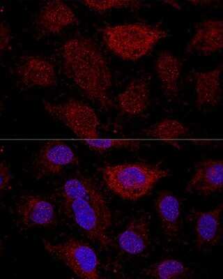 Immunocytochemistry/Immunofluorescence: RPL21 Antibody [NBP2-93190] - Analysis of HeLa cells using RPL21 at dilution of 1:200. Blue: DAPI for nuclear staining.