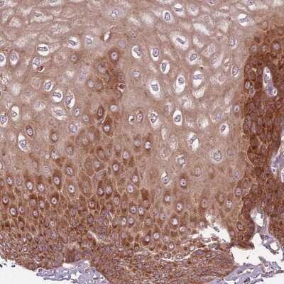 Immunohistochemistry-Paraffin: RPL21 Antibody [NBP2-13252] - Staining of human esophagus shows strong cytoplasmic positivity in squamous epithelial cells.