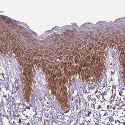 Immunohistochemistry-Paraffin: RPL21 Antibody [NBP2-13252] - Staining of human Skin shows moderate cytoplasmic positivity in squamous epithelial cells.