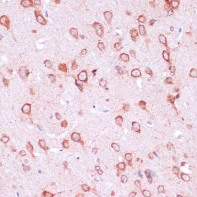 Immunohistochemistry-Paraffin: RPL21 Antibody [NBP2-93190] - Paraffin-embedded rat brain using RPL21 .