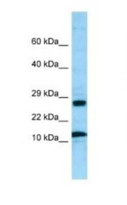 Western Blot: RPL21 Antibody [NBP1-98533] - Titration: 1.0 ug/ml Positive Control: MCF7 Whole Cell.