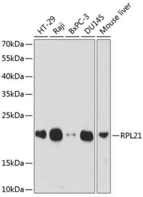 Western Blot: RPL21 Antibody [NBP2-93190] - Analysis of extracts of various cell lines, using RPL21 at 1:1000 dilution. Secondary antibody: HRP Goat Anti-Rabbit IgG (H+L) at 1:10000 dilution. Lysates/proteins: 25ug per lane. Blocking buffer: 3% nonfat dry milk in TBST. Detection: ECL Basic Kit . Exposure time: 60s.