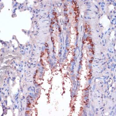 <b>Genetic Strategies Validation. </b>Immunohistochemistry-Paraffin: RPL22 Antibody [NBP2-93082] -  Rat lung using RPL22 antibody at dilution of 1:100 (40x lens).Perform microwave antigen retrieval with 10 mM PBS buffer pH 7.2 before commencing with IHC staining protocol.