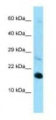 Western Blot: RPL22 Antibody [NBP1-98446] - Mouse Heart Lysate 1.0ug/ml, Gel Concentration: 10-20%