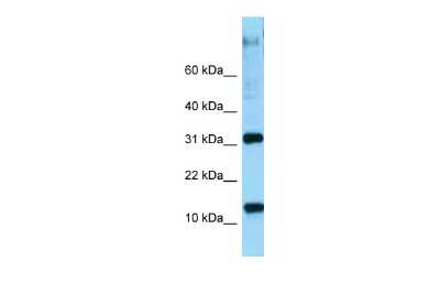 Western Blot: RPL22 Antibody [NBP2-86783] - WB Suggested Anti-RPL22 Antibody. Titration: 1.0 ug/ml. Positive Control: Placenta