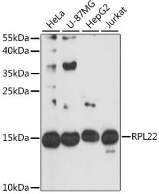 Western Blot: RPL22 Antibody [NBP2-93082] - Analysis of extracts of various cell lines, using RPL22 at 1:3000 dilution. Secondary antibody: HRP Goat Anti-Rabbit IgG (H+L) at 1:10000 dilution. Lysates/proteins: 25ug per lane. Blocking buffer: 3% nonfat dry milk in TBST. Detection: ECL Basic Kit . Exposure time: 30s.