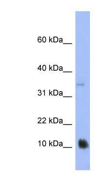 Western Blot: RPL23AP82 Antibody [NBP1-57370] - Human Stomach, concentration 0.2-1 ug/ml.
