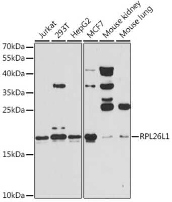 Western Blot: RPL26L1 Antibody [NBP2-94837] - Analysis of extracts of various cell lines, using RPL26L1 at 1:3000 dilution. Secondary antibody: HRP Goat Anti-Rabbit IgG (H+L) at 1:10000 dilution. Lysates/proteins: 25ug per lane. Blocking buffer: 3% nonfat dry milk in TBST. Detection: ECL Basic Kit . Exposure time: 60s.