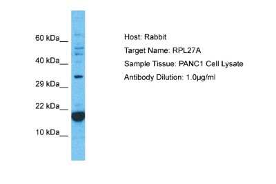 Western Blot: RPL27A Antibody [NBP2-85658] - Host: Rabbit. Target Name: RPL27A. Sample Type: PANC1 Whole Cell lysates. Antibody Dilution: 1.0ug/ml