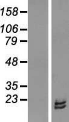 Western Blot: RPL31 Overexpression Lysate (Adult Normal) [NBL1-15525] Left-Empty vector transfected control cell lysate (HEK293 cell lysate); Right -Over-expression Lysate for RPL31.