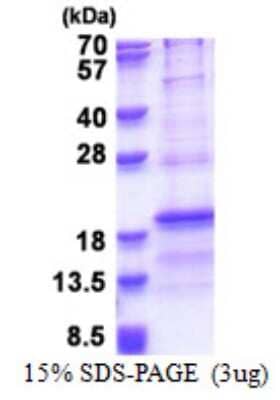 SDS-Page: RPL31 Protein [NBP2-23424]