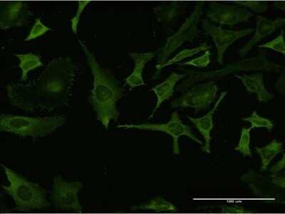 Immunocytochemistry/Immunofluorescence: RPL32 Antibody (1B11) [H00006161-M04] - Analysis of monoclonal antibody to RPL32 on HeLa cell. Antibody concentration 10 ug/ml