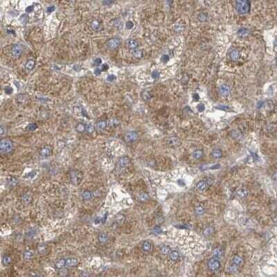 Immunohistochemistry-Paraffin: RPL32 Antibody [NBP2-30682] - Staining of human liver.