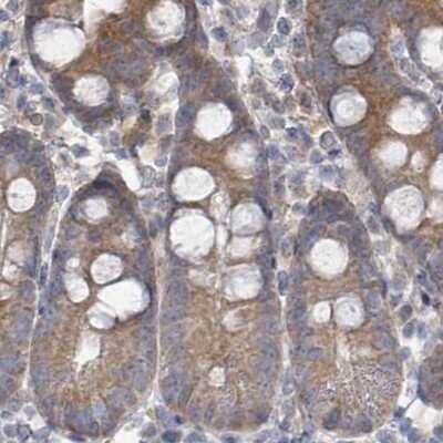 Immunohistochemistry-Paraffin: RPL32 Antibody [NBP2-30682] - Staining of human small intestine.