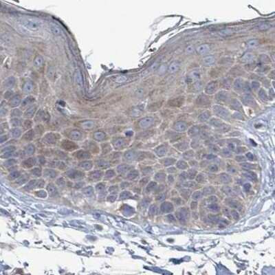 Immunohistochemistry-Paraffin: RPL32 Antibody [NBP2-30682] - Staining of human skin.