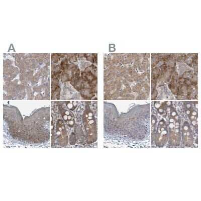 <b>Independent Antibodies Validation. </b>Immunohistochemistry-Paraffin: RPL32 Antibody [NBP2-48874] - Staining of human liver, pancreas, skin and small intestine using Anti-RPL32 antibody NBP2-48874 (A) shows similar protein distribution across tissues to independent antibody NBP2-30682 (B).