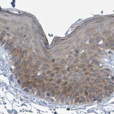 Immunohistochemistry-Paraffin: RPL32 Antibody [NBP2-48874] - Staining of human skin.