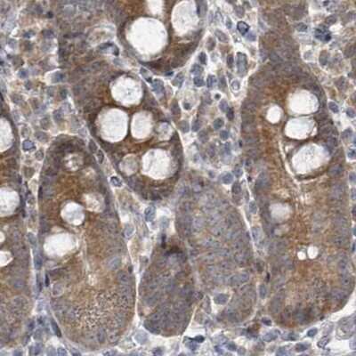 Immunohistochemistry-Paraffin: RPL32 Antibody [NBP2-48874] - Staining of human small intestine.