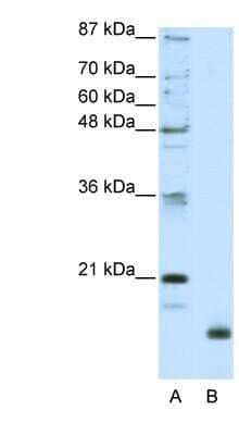 Western Blot: RPL32 Antibody [NBP1-80442] - HepG2 cell lysate, concentration 2.5 ug/ml.